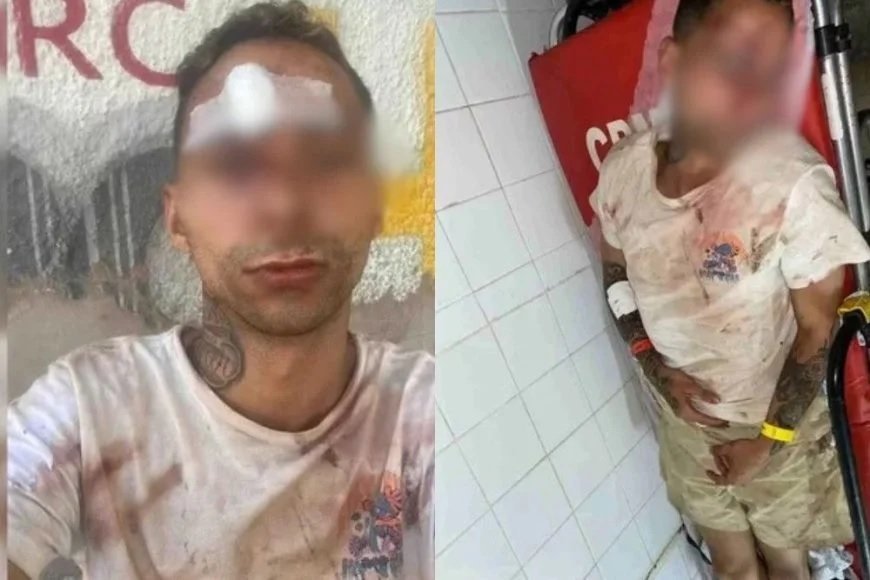 Casal gay é espancado dentro de banheiro por 8 homens